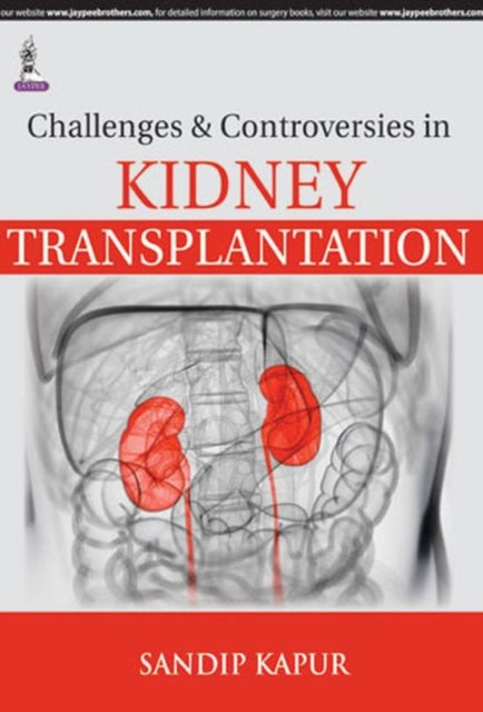 Challenges and Controversies in Kidney