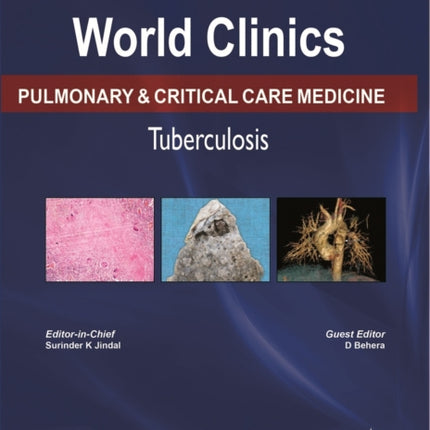 World Clinics: Pulmonary & Critical Care Medicine - Tuberculosis, Volume 3, No: 1