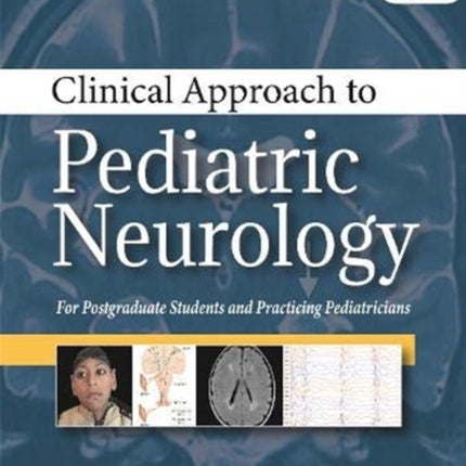 Clinical Approach to Pediatric Neurology: For