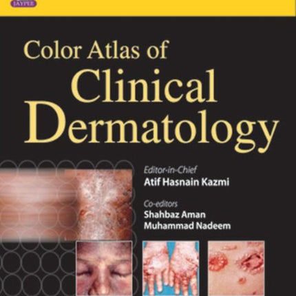 Color Atlas of Clinical Dermatology