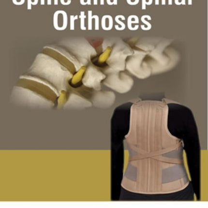 Spine and Spinal Orthosis