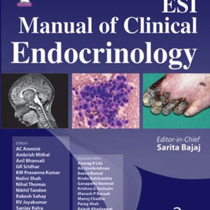 ESI Manual of Clinical Endocrinology