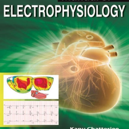 Manual of Electrophysiology