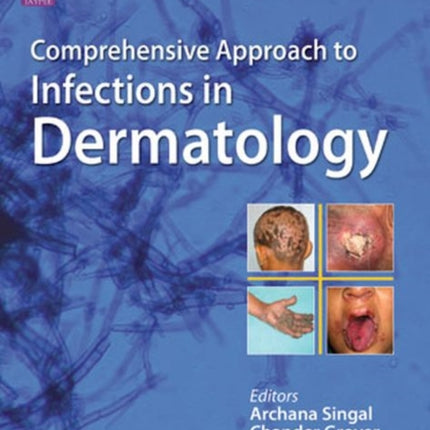 Comprehensive Approach to Infections in Dermatology