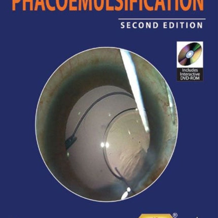 Jaypee Gold Standard Mini Atlas Series: Phacoemulsification