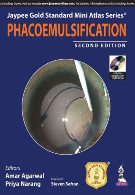 Jaypee Gold Standard Mini Atlas Series: Phacoemulsification