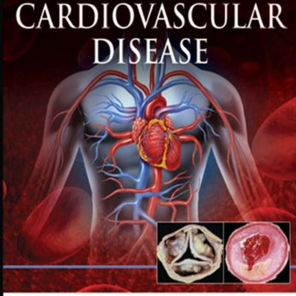 Illustrated Guide to Cardiovascular Disease