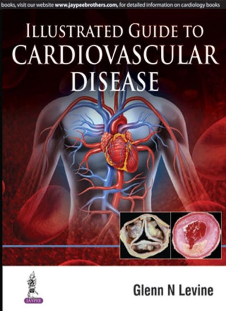 Illustrated Guide to Cardiovascular Disease