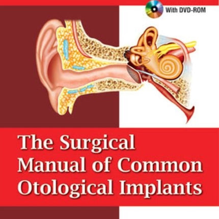 The Surgical Manual of Common Otological Implants