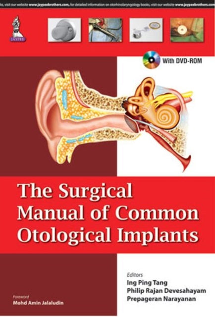 The Surgical Manual of Common Otological Implants