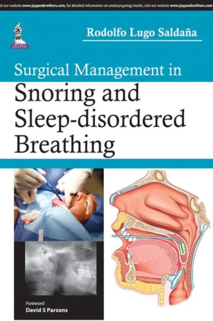 Surgical Management in Snoring and Sleep-disordered Breathing