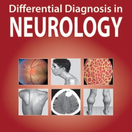 Differential Diagnosis in Neurology