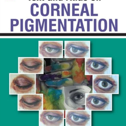 Text and Atlas on Corneal Pigmentation