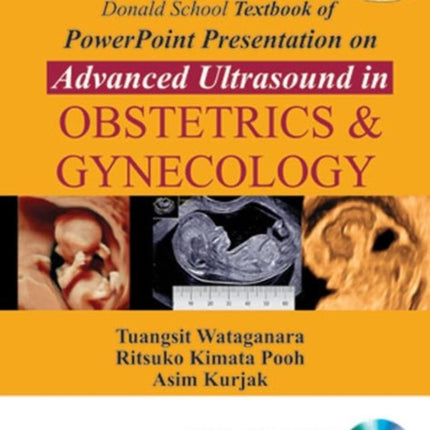 Donald School Textbook of Powerpoint Presentation on Advanced Ultrasound in Obstetrics & Gynecology