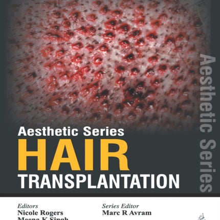 Aesthetic Series - Hair Transplantation