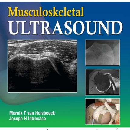 Musculoskeletal Ultrasound