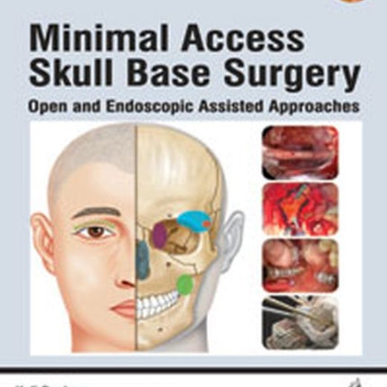 Minimal Access Skull Base Surgery: Open and Endoscopic Assisted Approaches