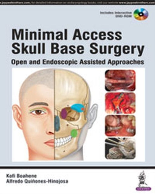 Minimal Access Skull Base Surgery: Open and Endoscopic Assisted Approaches