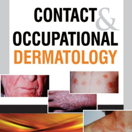 Contact & Occupational Dermatology