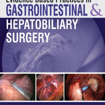 Evidence Based Practices in Gastrointestinal & Hepatobiliary Surgery