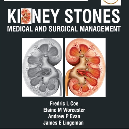 Kidney Stones: Medical and Surgical Management