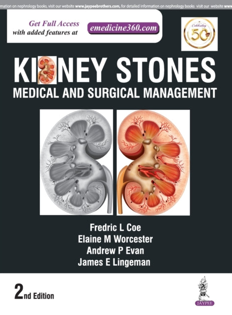 Kidney Stones: Medical and Surgical Management