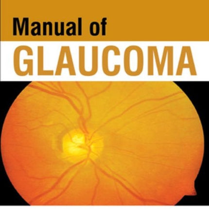 Manual of Glaucoma