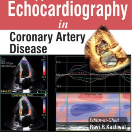 Applied Echocardiography in Coronary Artery