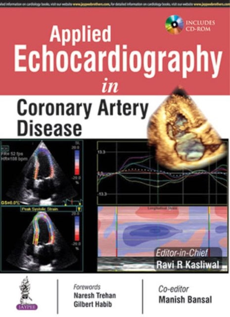 Applied Echocardiography in Coronary Artery