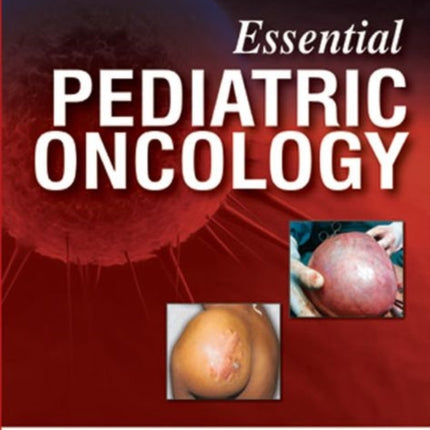 Essential Pediatric Oncology