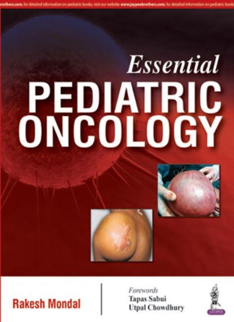 Essential Pediatric Oncology