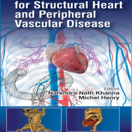 Handbook of Interventions for Structural Heart and Peripheral Vascular Disease