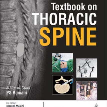 WFNS Spine Committee Textbook on Thoracic Spine