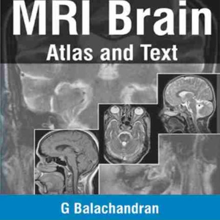 MRI Brain: Atlas and Text