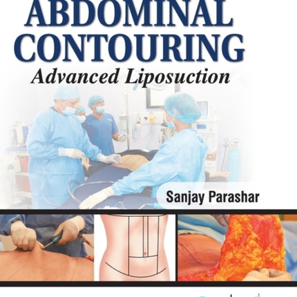 Art of Abdominal Contouring: Advanced Liposuction