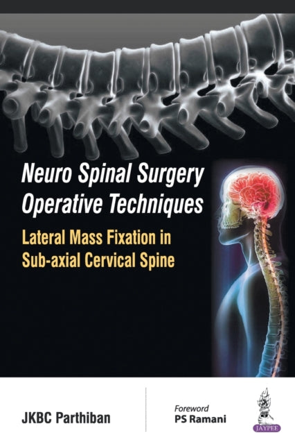 Neuro Spinal Surgery Operative Techniques: Lateral Mass Fixation in Sub-axial Cervical Spine