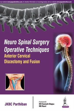 Neuro Spinal Surgery Operative Techniques: Anterior Cervical Discectomy and Fusion