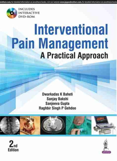 Interventional Pain Management: A Practical Approach