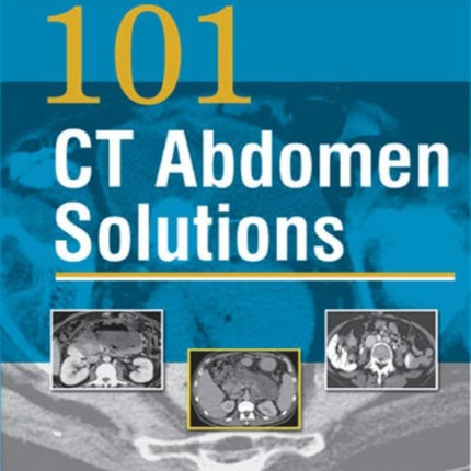 101 CT Abdomen Solutions