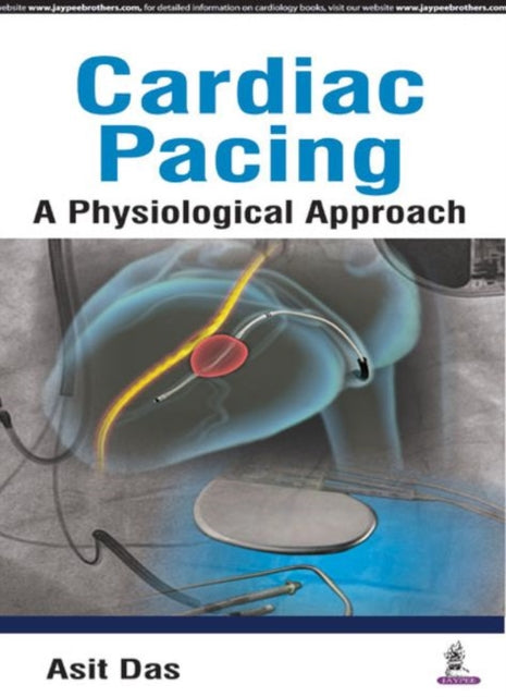 Cardiac Pacing A Physiological Approach