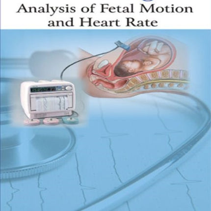 Actocardiogram: Analysis of Fetal Motion and Heart Rate