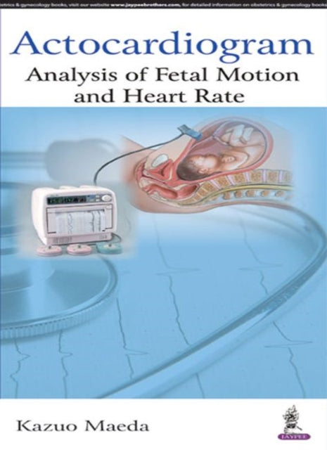 Actocardiogram: Analysis of Fetal Motion and Heart Rate