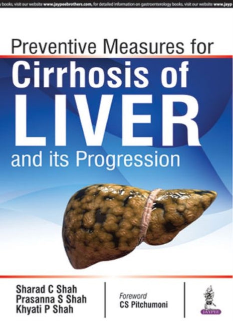 Prevention Measures for Cirrhosis of Liver and its Progression