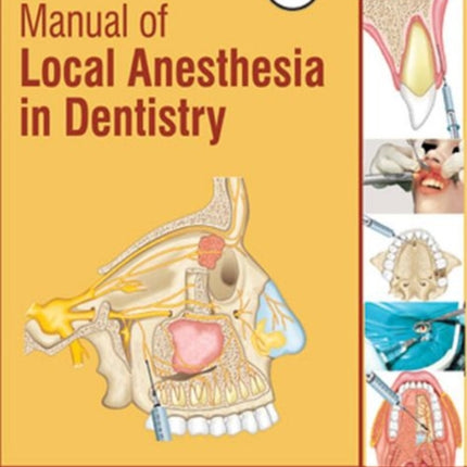 Manual of Local Anaesthesia in Dentistry