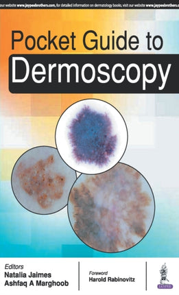 Pocket Guide to Dermoscopy