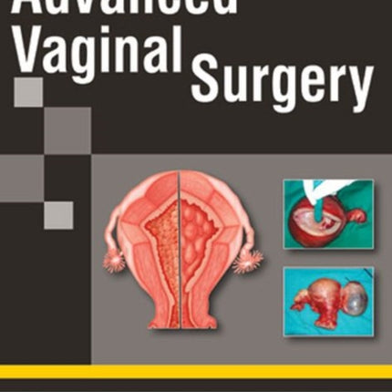 Advanced Vaginal Surgery