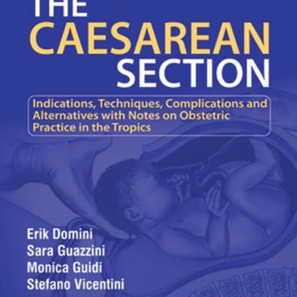 The Caesarean Section