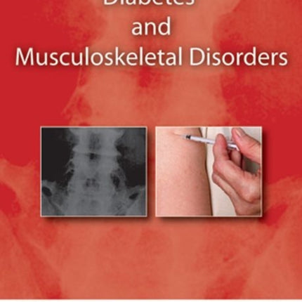 Diabetes and Musculoskeletal Disorders