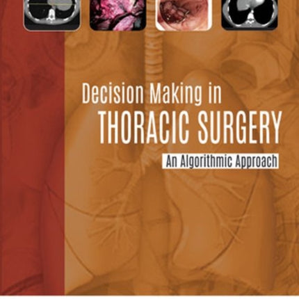 Decision Making in Thoracic Surgery: An Algorithmic Approach