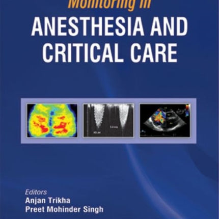 Monitoring in Anesthesia and Critical Care